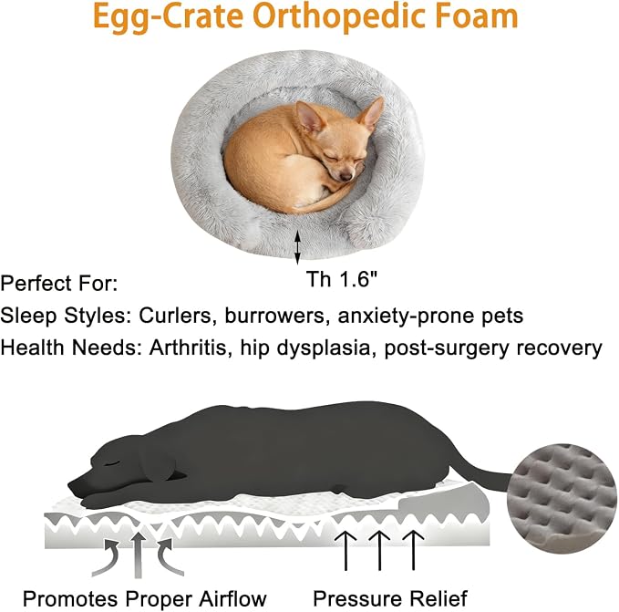 Calming Dog & Cat Beds with Orthopedic Egg-Crate Foam Raised Rim, Soft Fluffy Faux Fur Pet Bed for Small Medium Dogs, Anxiety Relief Spine Support, Machine Washable (Round, Pale Grey 20")