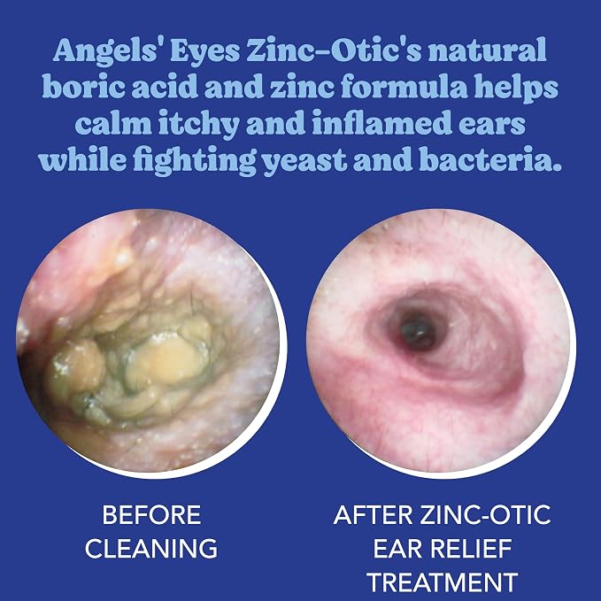 Angels’ Eyes Zinc-Otic Ear Relief Treatment for Dogs and Cats Soothe Ear Infections Calm Itchy Inflamed Ears Natural BA and Zinc Formula 1 Ounce